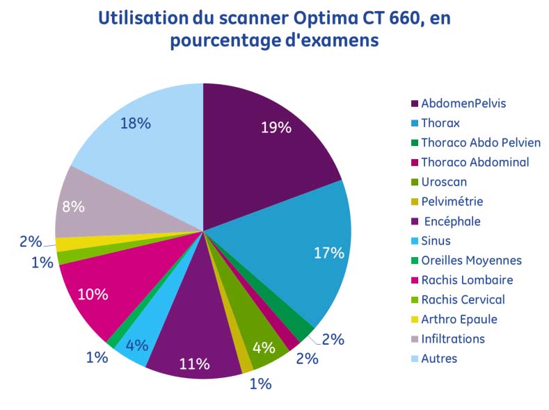 Scanner pourcentage